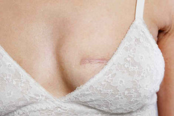 What to Wear After Lumpectomy Surgery