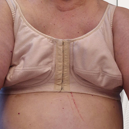 Teardrop Breast Form (Single) Post-Mastectomy
