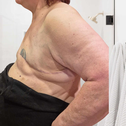 Teardrop Breast Form (Single) Post-Mastectomy