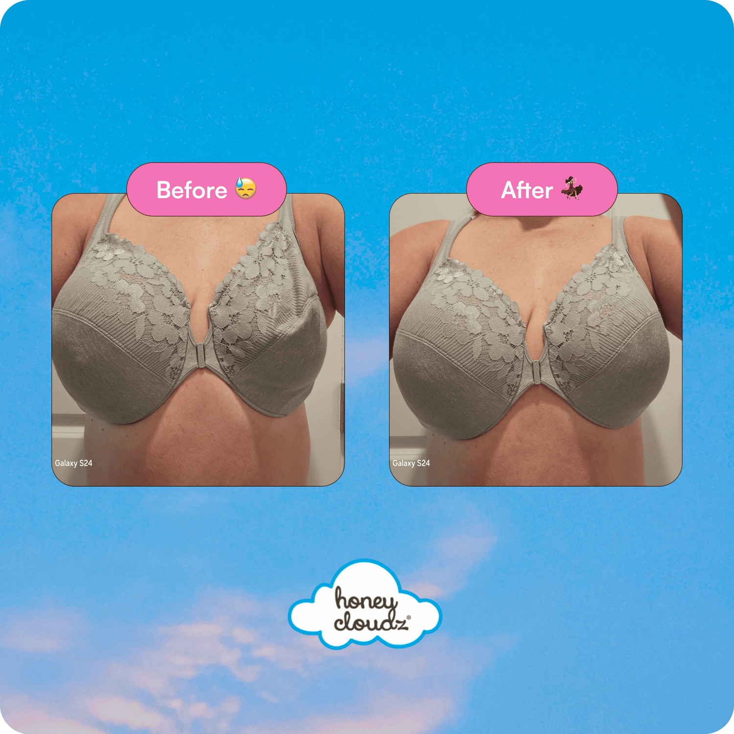 Teardrop Breast Form Insert – Post-Mastectomy &amp; Reconstruction